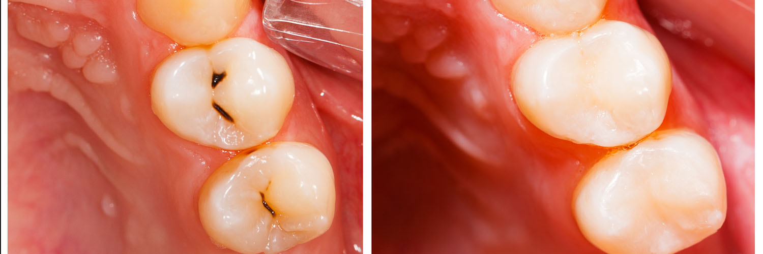 Diablo Creek Dentistry